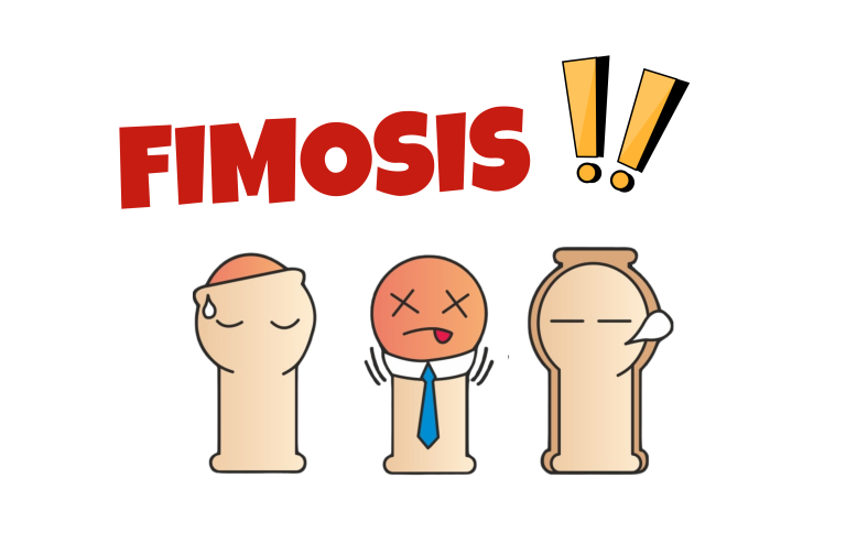 fimosis dan khitan