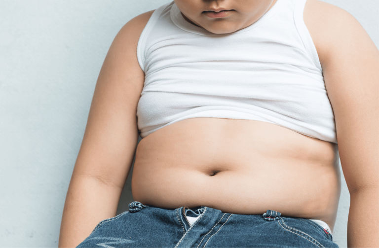 Anak Overweight, Ini Dampaknya Saat Khitan